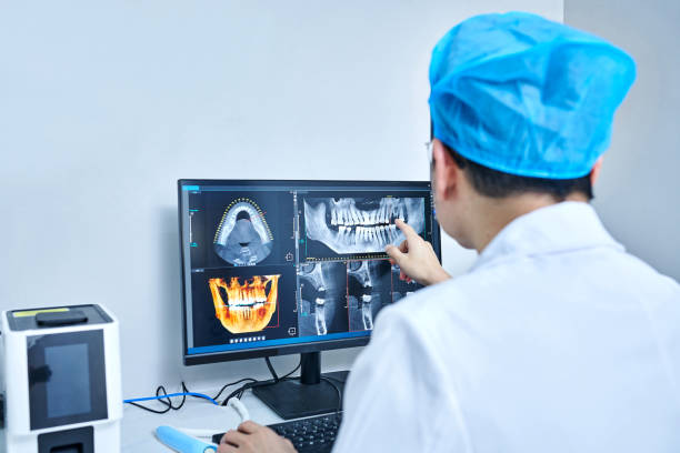 Best Emergency Wisdom Teeth Removal in Montgomery, IL